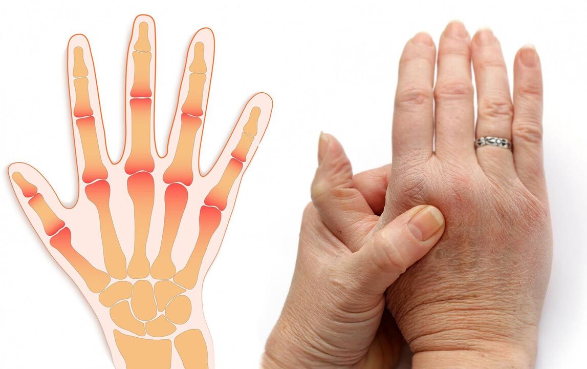 diseases of the fingers