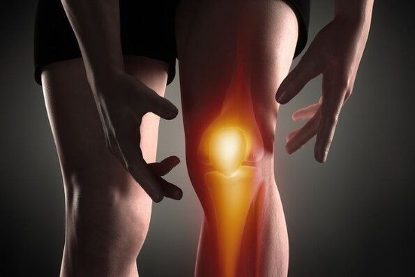 Knee arthrosis