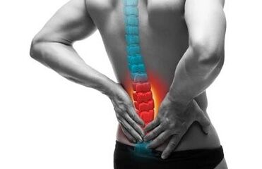 Osteochondrosis is a disease of the spine